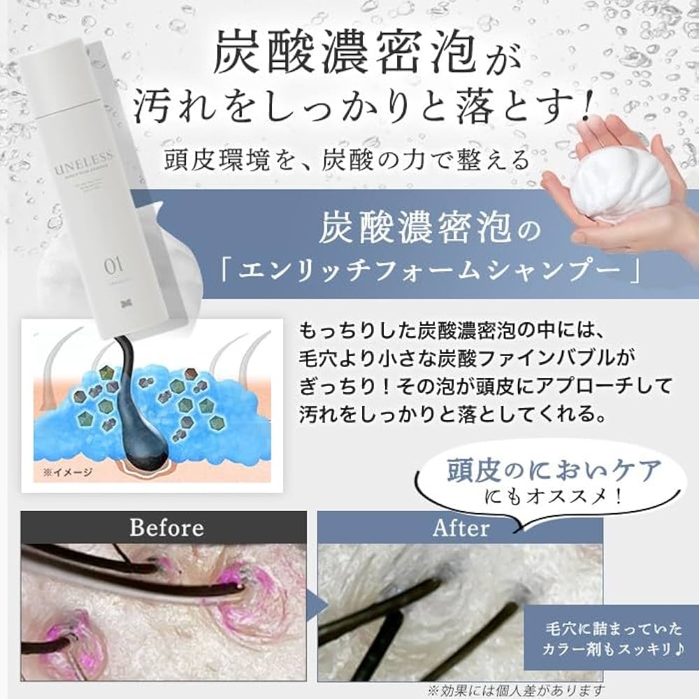 ウネレス炭酸シャンプー Amazon | UNELESS ウネレス 特別セット 炭酸シャンプー